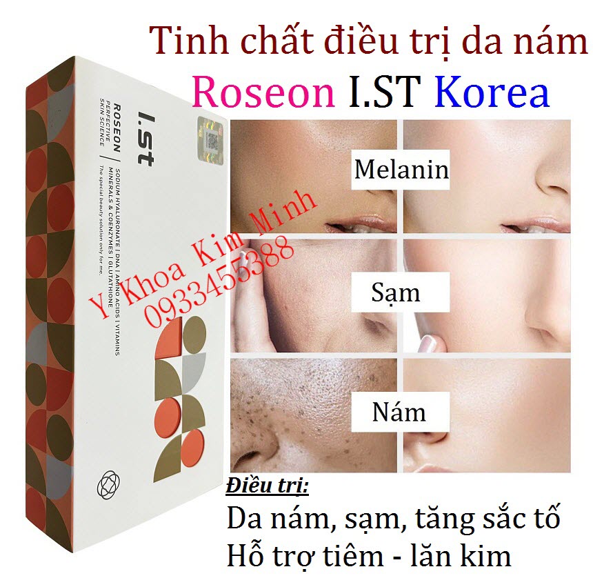 Tinh chất Roseon vừa tiêm nám, vừa dùng lăn kim trị nám của Hàn Quốc
