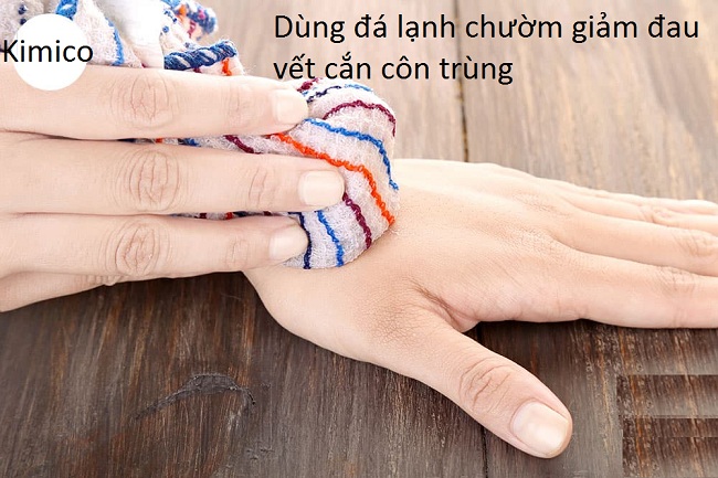 Dùng đá viên chườm giảm đau vết cắn côn trùng - Y khoa Kim Minh