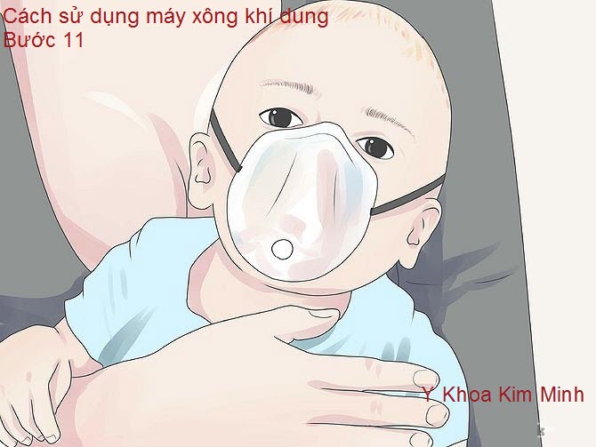 Đặt mask thở khí dung vào vị trí mũi và miệng của bé và quàng dây ra sau