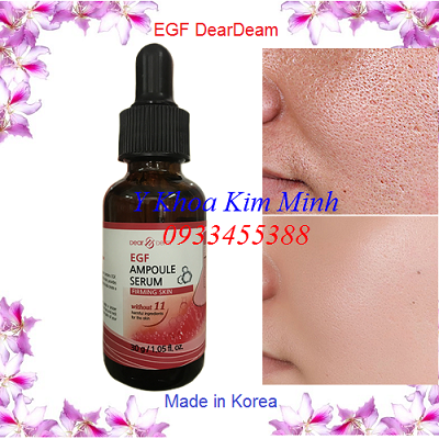 EGF Hàn Quốc, huyết thanh chuyên nghiệp trẻ hóa da mặt Baby - Y Khoa Kim Minh