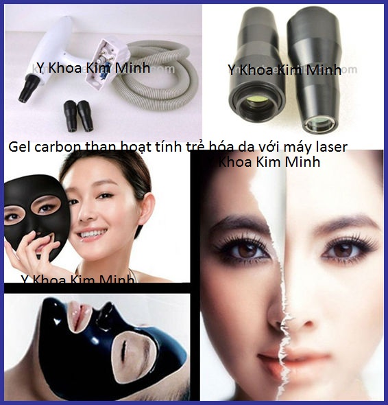 Ban dau ban laser den 1320nm và gel carbon mask Y Khoa Kim Minh
