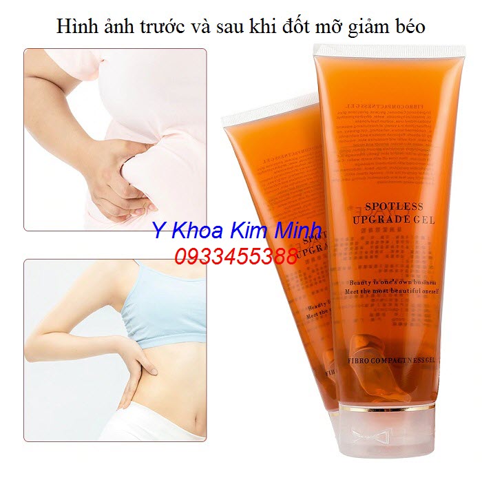 Đáh tan mỡ thừa, siết cơ body với máy RF - Y khoa Kim Minh