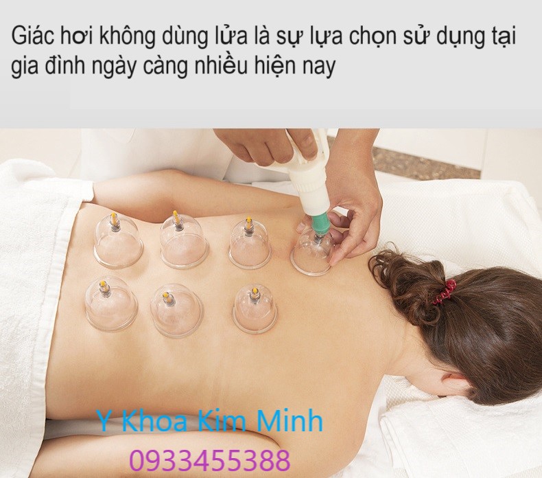Công dụng của giác hơi không dùng lửa