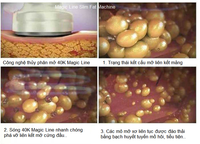 Thuy phan mo bang cong nghe 40K Magic Line Kim Minh 0933455388 tại Tp Hochiminh