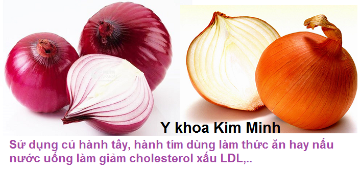 Giam cholesterol xau, ngan ngua tai bien dot quy bang cu hanh tay cu hanh tim nau nuoc hay dung lam thuc an Y khoa Kim Minh