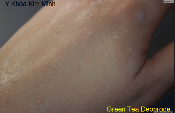 Dia chi ban kem tay te bao chet tai tp ho chi minh Green Tea Deoproce Y khoa Kim Minh