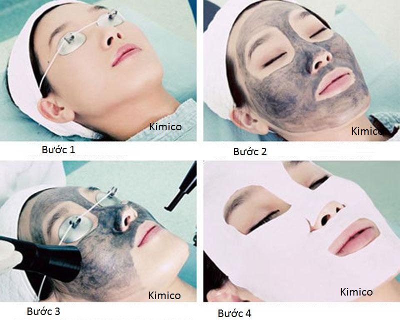 Máy xóa xăm trẻ hóa da Yag laser V9