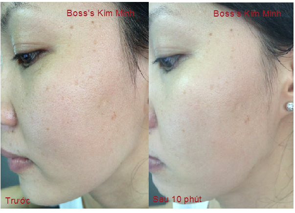 HDSD máy chăm sóc da mặt mini