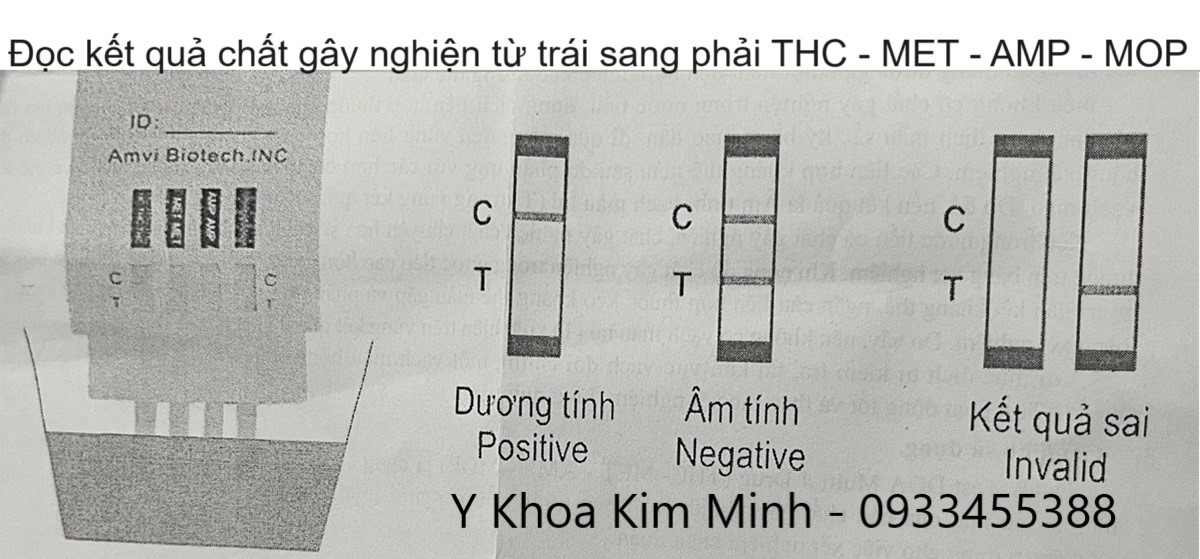 Hướng dẫn đọc Test xét nghiệm nhanh ma túy tổng hợp THC - MET - AMP - MOP
