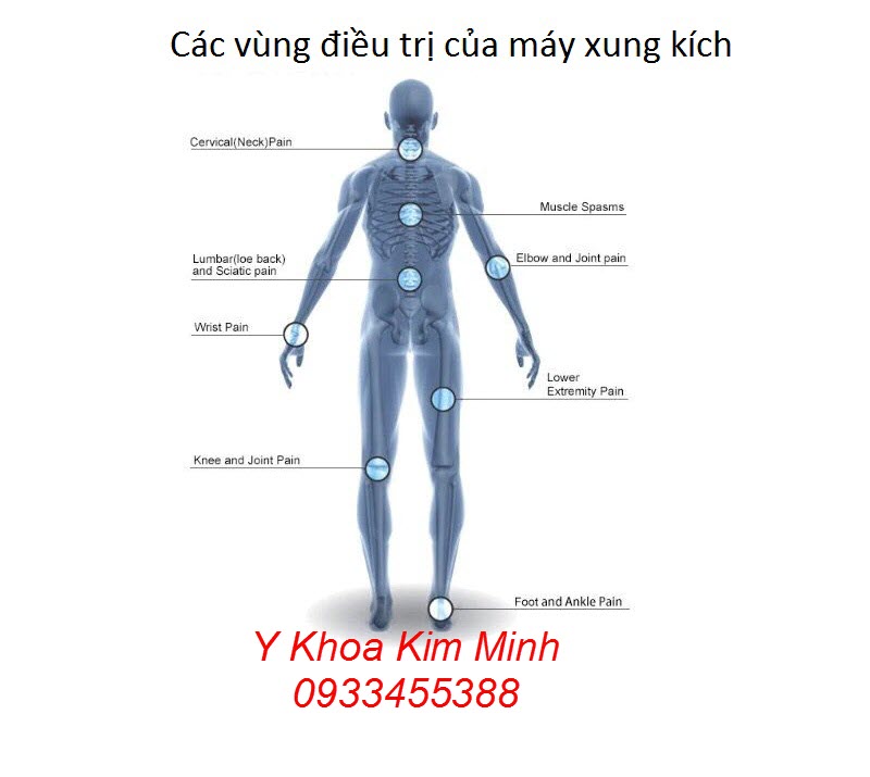 Các vùng điều trị máy xung kích KSW11 Hướng dẫn sử dụng máy shockwave KSW11 Kim Minh