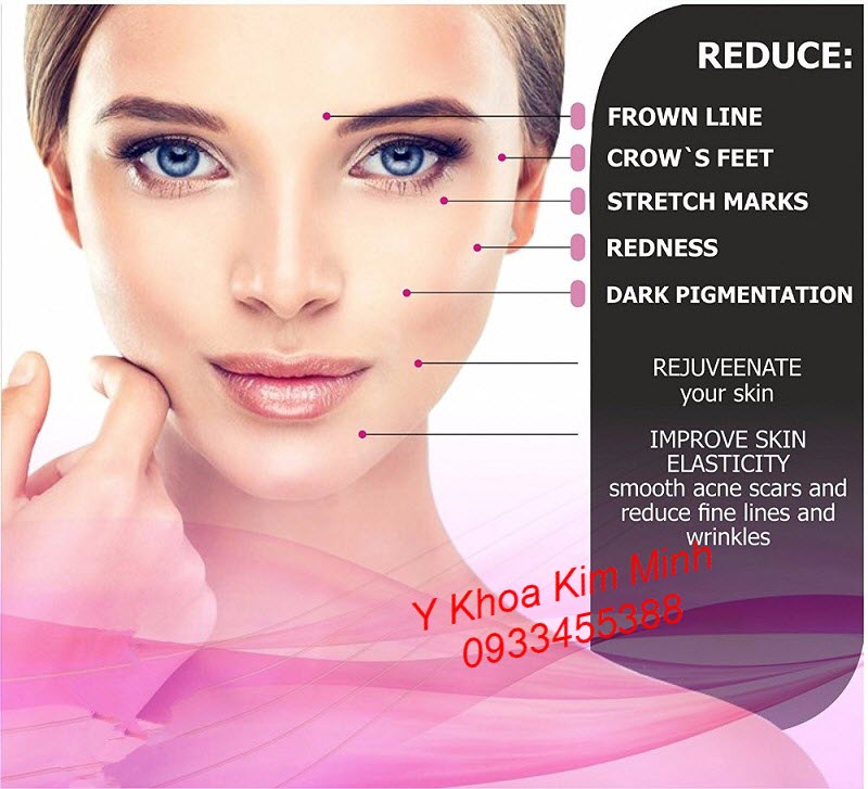 Hướng dẫn cách phi kim trên da mặt bằng máy Dr Pen