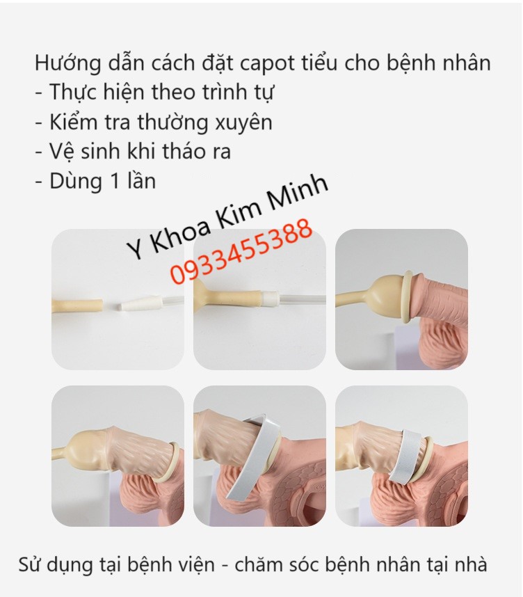 Cách sử dụng đặt capot tiểu cho bệnh nhân nằm liệt tại giường y tế