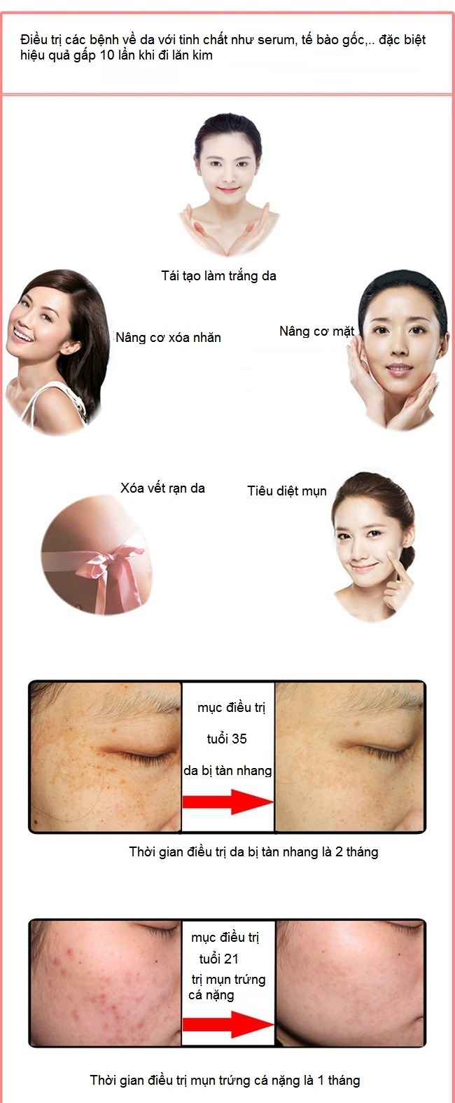 Huong dan su dung may lan kim dien thay the loai vang 18K Y Khoa Kim Minh