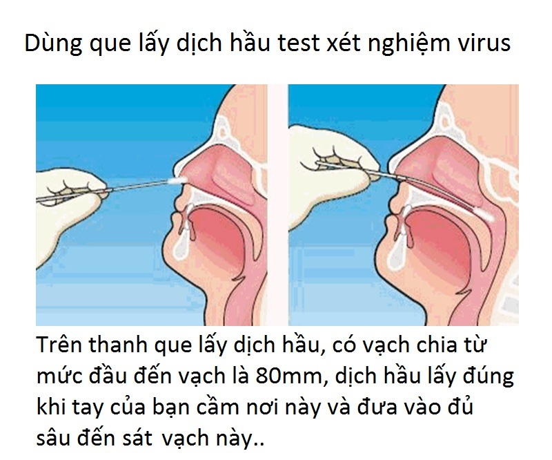 Hướng dẫn dùng que lấy dịch hầu mũi của que lấy dịch hầu bệnh phẩm