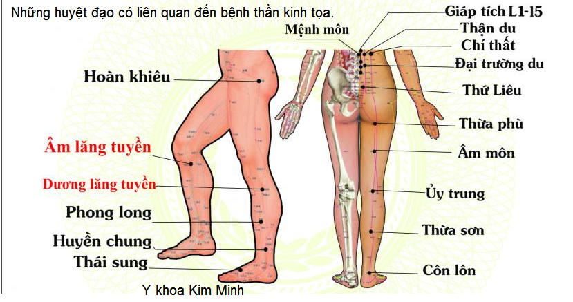 Đai DT-350 chữa bệnh có liên quan đến bệnh thần kinh tọa - Y khoa Kim Minh 0933455388