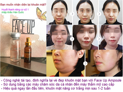 Huyết thanh Face Up đi nâng cơ, trắng da Hàn Quốc - Y khoa Kim Minh