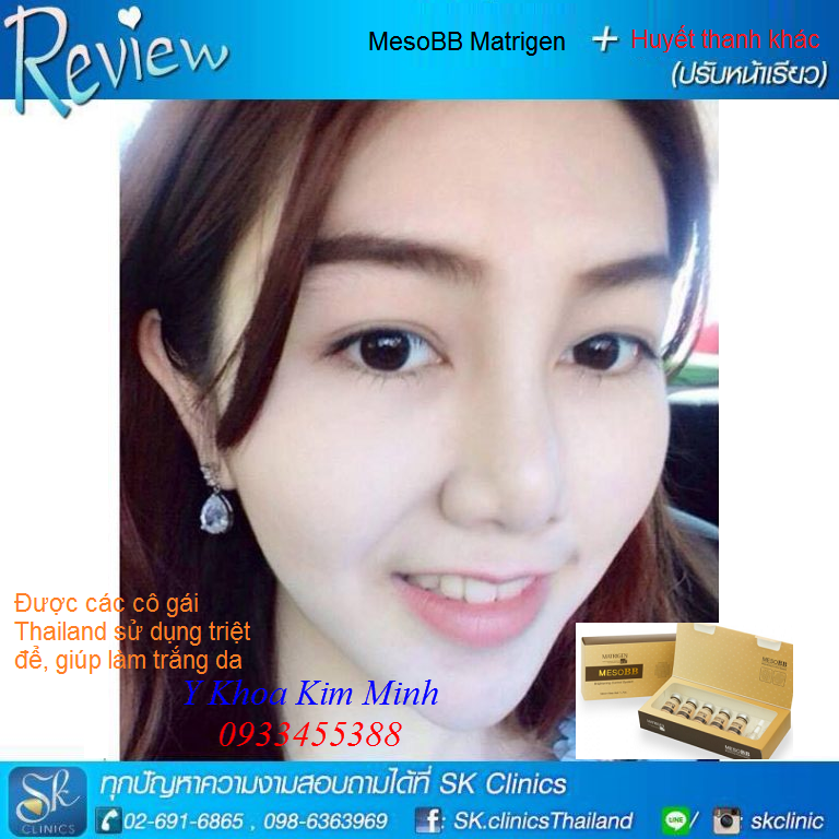 MesoBB Metrigen kích trắng da tức thì luôn là lựa chọn hàng đầu của các cô gái Thái Lan - Y Khoa Kim Minh