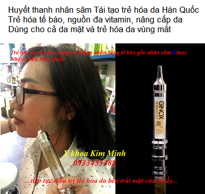 Huyết thanh nhân sâm Hàn Quốc Ginox chuyên dưỡng sau đi máy HIFU giúp nâng cơ trẻ hóa da mặt - Y Khoa Kim MInh