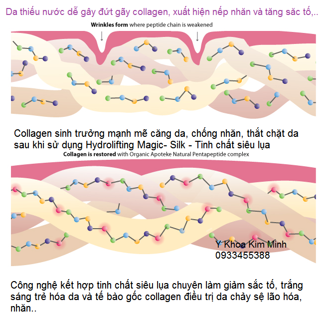 Tinh chat sieu lua trang sang tri nam tai tao da lao hoa Hydrolifting Magic-Silk - Y khoa Kim Minh