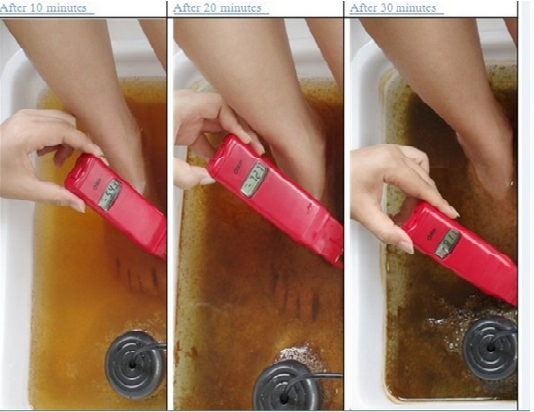 may ion dien ngam chan thai doc to