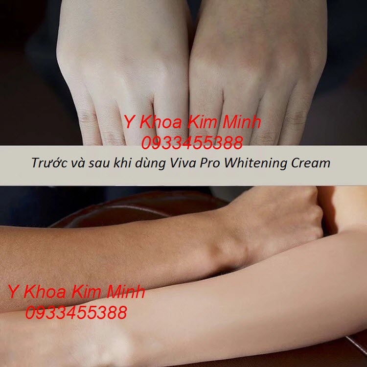 Kết quả làm trắng da siêu nhanh sau khi dùng kem dưỡng trắng da Viva Pro Whitening