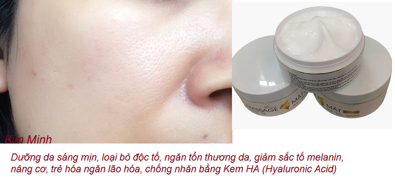 Kem massage duong da mat sang trang min chong lao hoa HA nhap Thai Lan ban tai Y Khoa Kim Minh