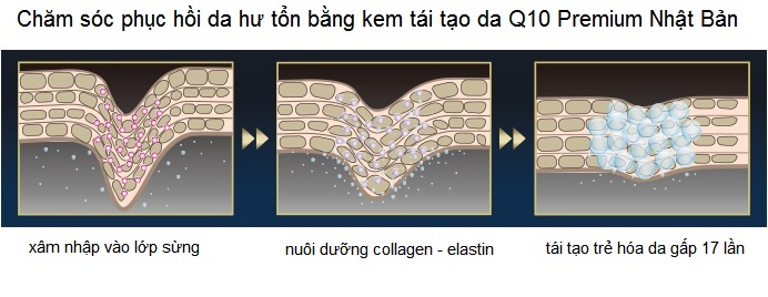 Kem tre hoa tai tao da Q10 Premium Nhat Ban phan phoi gia si tai Y Khoa Kim Minh