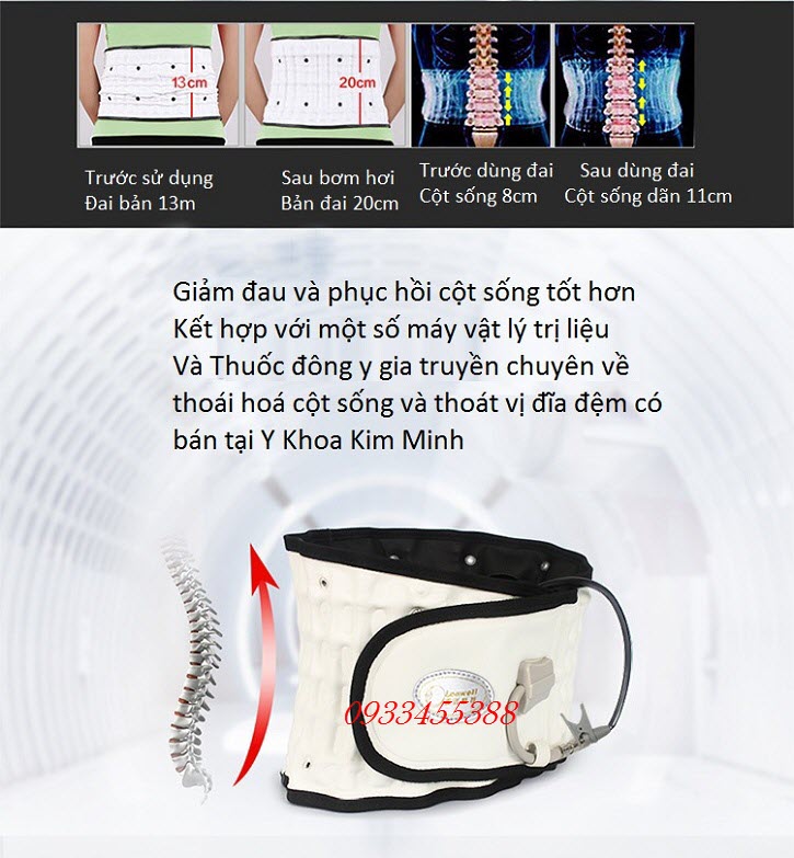 Kết quả trước và sau khi dùng đai cột sống bơm hoi chữa thoái hoá đốt sống lưng L1, L2, L3, L4, L5, thoát vị đĩa đệm, thần kinh toạ, vôi cột sống - Y Khoa Kim Minh