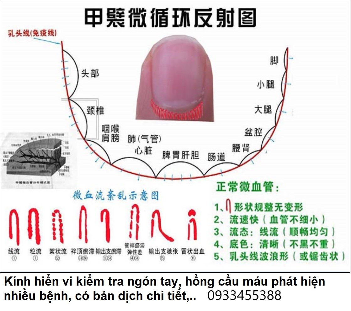Kính hiển vi kiểm tra vi tuần hoàn máu