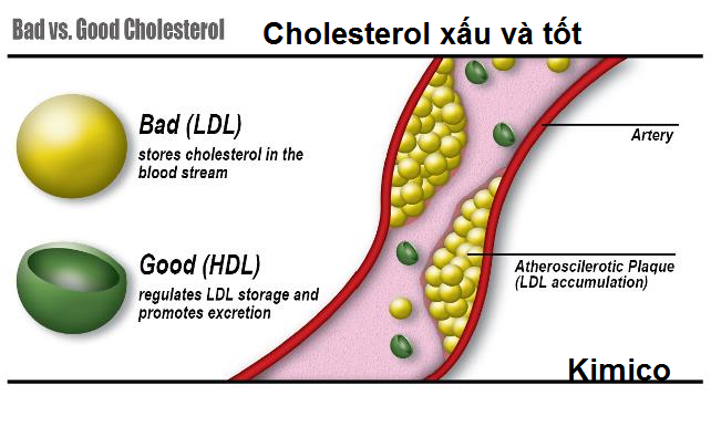 Moi lien he giua cholesterol mau cao va huyet ap cao gay benh tim mach va dot quy Y khoa Kim Minh