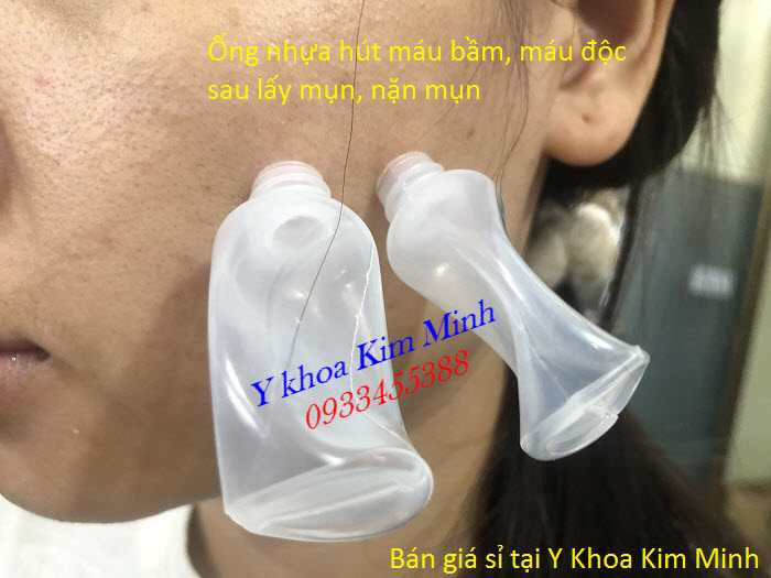 Cung cấp ống hút mụn, lọ hút máu bầm, nhíp gấp mụn, kim lễ mụn, serum trị mụn tại Y Khoa Kim Minh