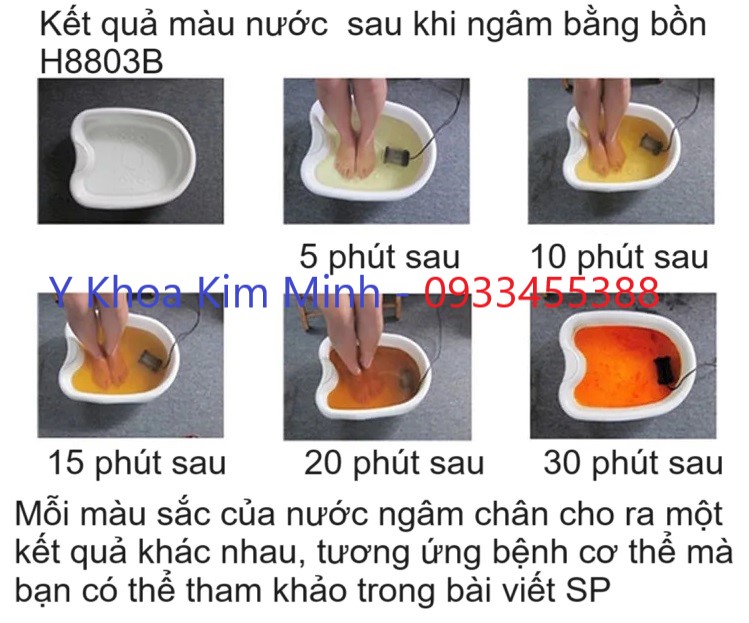 Kết quả sau khi dùng bồn ngâm chân ion thải độc H8803B