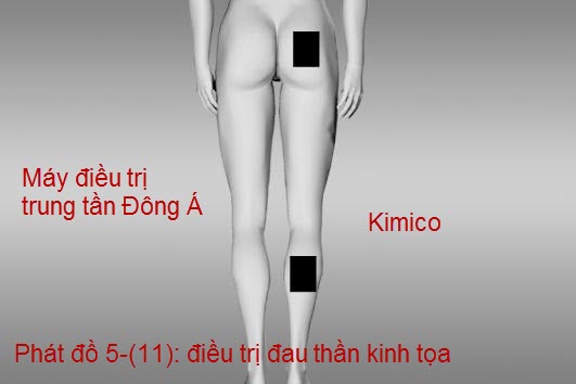 Chữa bệnh điều trị đau nhứt do vi&ecirc;m d&acirc;y thần kinh tọa bằng m&aacute;y điều trị liệu Trung Tần Đ&ocirc;ng &Aacute; J18A2 ph&acirc;n phối bởi Y Khoa Kim Minh 93 Th&agrave;nh th&aacute;i