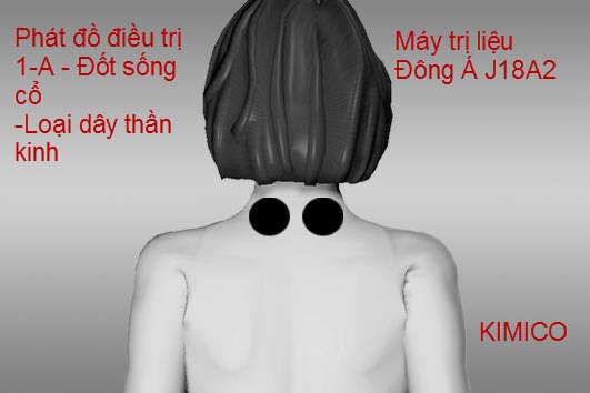 M&aacute;y điều trị trung tần Đ&ocirc;ng &Aacute; J18A2 Y Khoa Kim Minh sử dụng điều trị đốt sống cổ