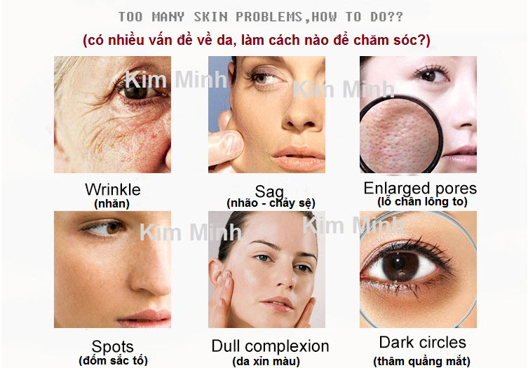 May Diaro Korea cham soc va dieu tri da cao cap Han Quoc ban tai Y Khoa Kim Minh 0933455388