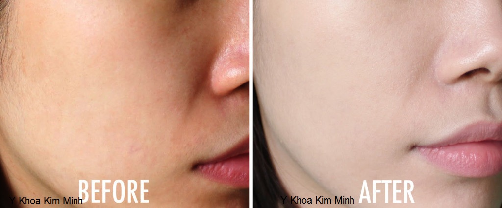 May Hitachi Hada Crie CM N3000 nhap khau phan phoi tai dia chi ban Y Khoa Kim Minh