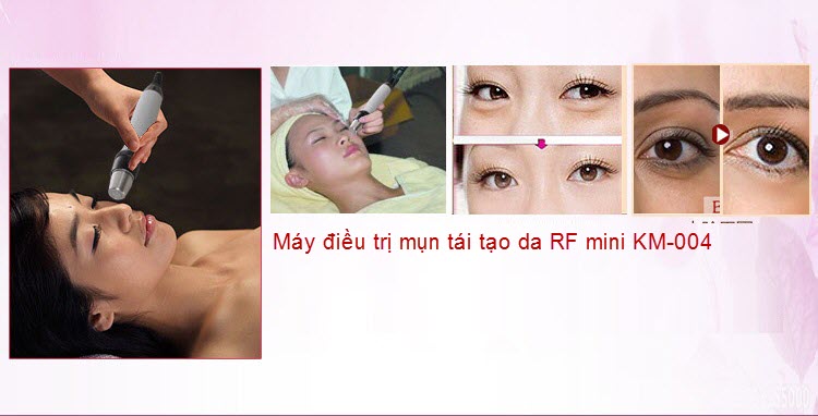 May tri mun tre hoa tai tao da RF mini KM-004
