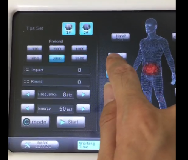 Dùng máy xung kích shockwave điều trị giảm béo - Y khoa Kim Minh Dùng máy xung kích shockwave điều trị giảm béo - Y khoa Kim Minh