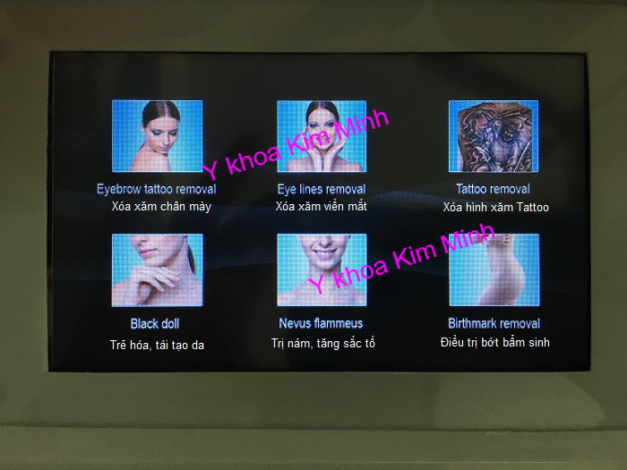 May ban laser xoa xam tri nam lam hong moi KLS50S Y khoa Kim Minh