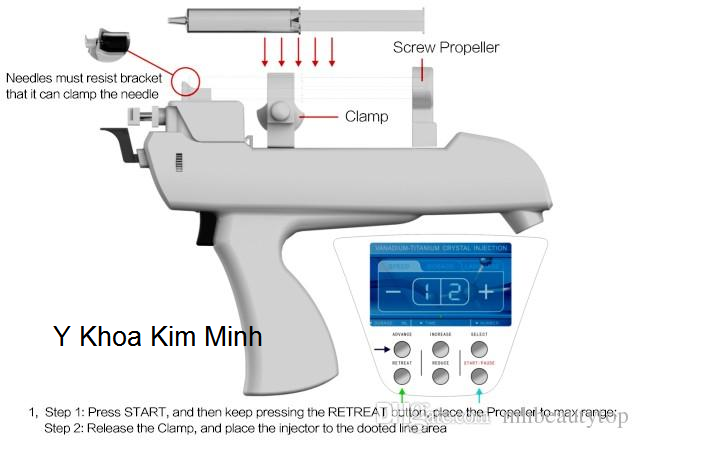 Sung tiem duong chat tu dong 5 kim mesogun Y khoa Kim Minh 0933455388 tai tp hochiminh