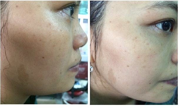 Máy chăm sóc da mặt cá nhân mini photon