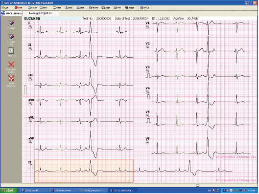 Hiển thị kết nối màn hình vi tính máy điện tim 6 cần suzuken 601