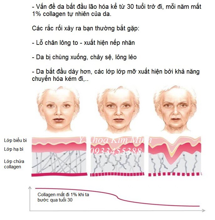 Noi ban may dieu tri da lao hoa chay se RF 3D KL-99 - Y khoa Kim Minh