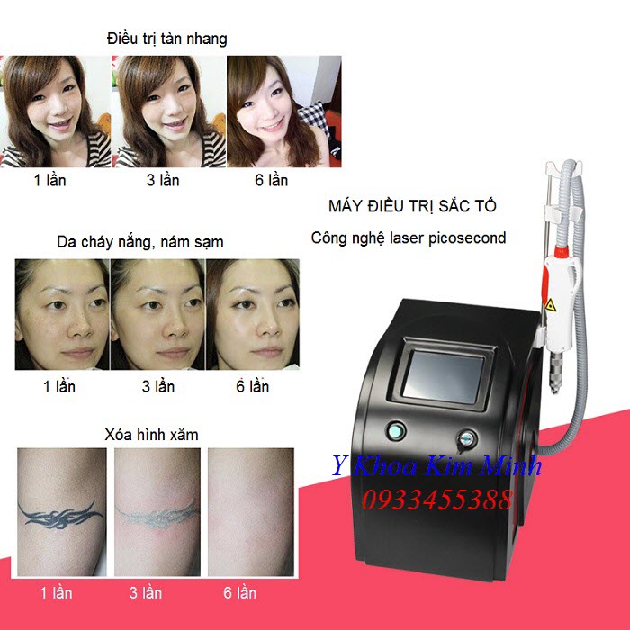 Máy điều trị sắc tố, máy laser picosecond 755nm bán tại Y khoa Kim Minh