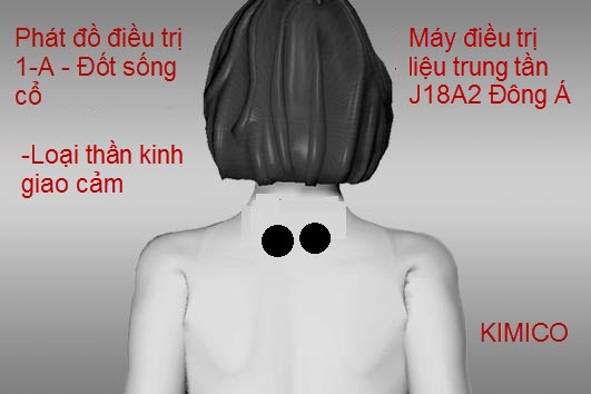 M&aacute;y điều trị trung tần chữa trị bệnh gai cột sống J18A2 Đ&ocirc;ng &Aacute; Y Khoa Kim Minh hiệu quả cao sau khi điều trị