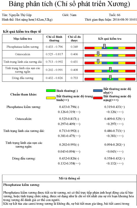 Máy đo chỉ số phát triển xương KG01