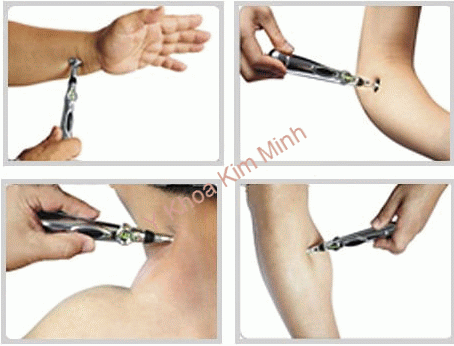 may dieu tri huyet dao co the su dung ca nhanh Y Khoa Kim Minh