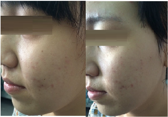 Máy chăm sóc da đi dưỡng chất mini