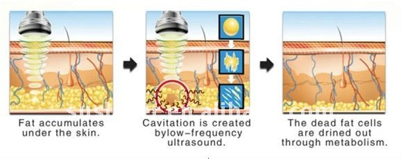 M&aacute;y giảm b&eacute;o to&agrave;n th&acirc;n KM-908 Caviation 40K RF