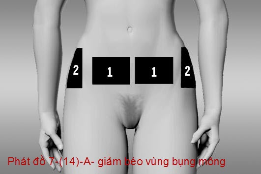 M&aacute;y điều trị giảm b&eacute;o hiệu quả bằng xung điện trung tần J18A2 b&aacute;n bởi Y Khoa Kim Minh